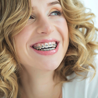 A young woman with blonde, curly hair, smiling while wearing traditional metal braces